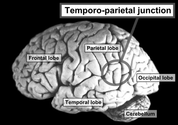 The temporoparietal junction, where a few seconds of current put a stranger behind a woman's shoulder